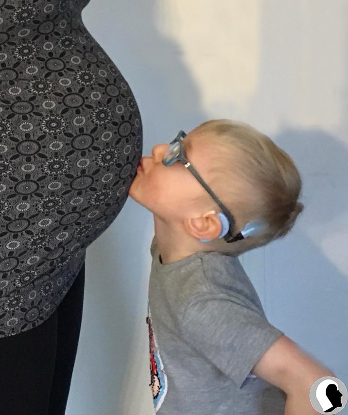 CI Kopf 2018 männlich Kind